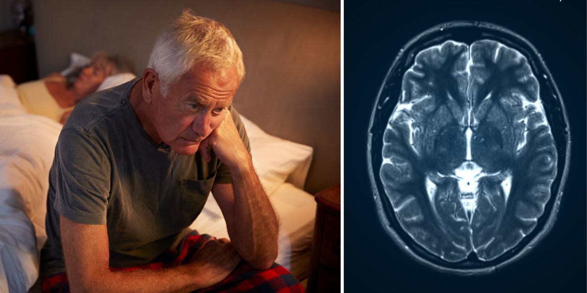 En man är vaken och en magnetkamerabild av en hjärna. Om du lider av dålig sömn kan din hjärna se äldre ut än vad den faktiskt är