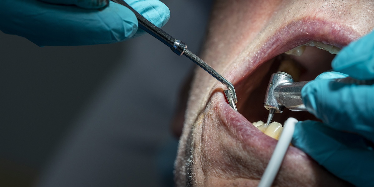 En patient får behandling av en tandläkare