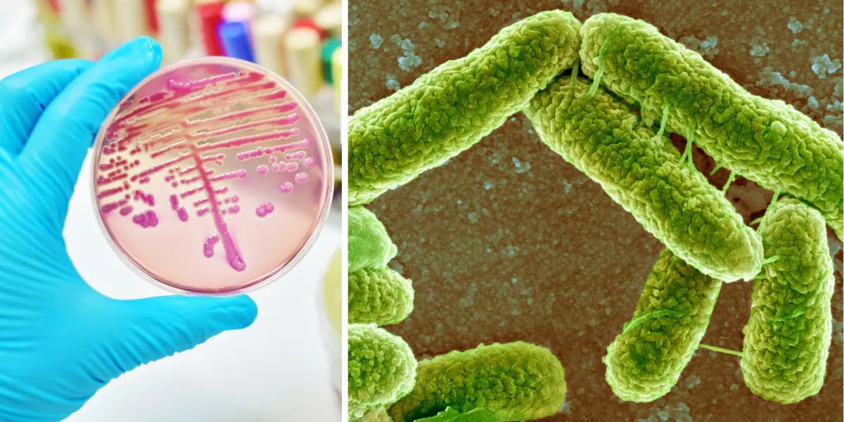 E. coli-bakterier odlade i en petriedisk och färgade i ett elektronmikroskop.