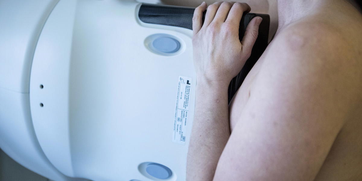 En kvinna gör mammografi, bröströntgen. Socialstyrelsen ska se över de nationella screeningprogrammen, bland annat den övre åldersgränsen för mammografi.