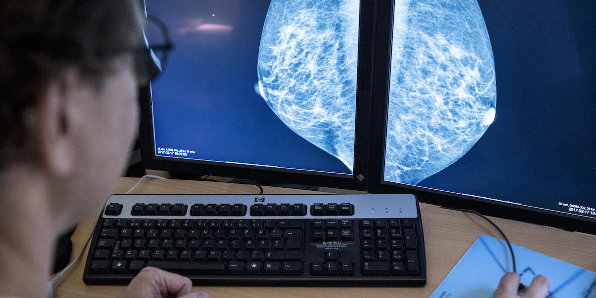 En läkare tittar på mammografibilder.