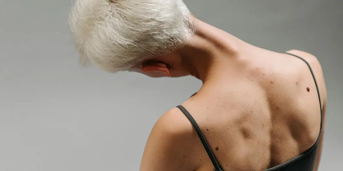 inflammation