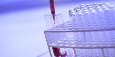Blodprover. Forskare vid Chalmers tekniska högskola och Göteborgs universitet har utvecklat en ny metod som gör det möjligt att analysera blodprover med mycket mindre cancer-DNA än vad som krävs i dag.