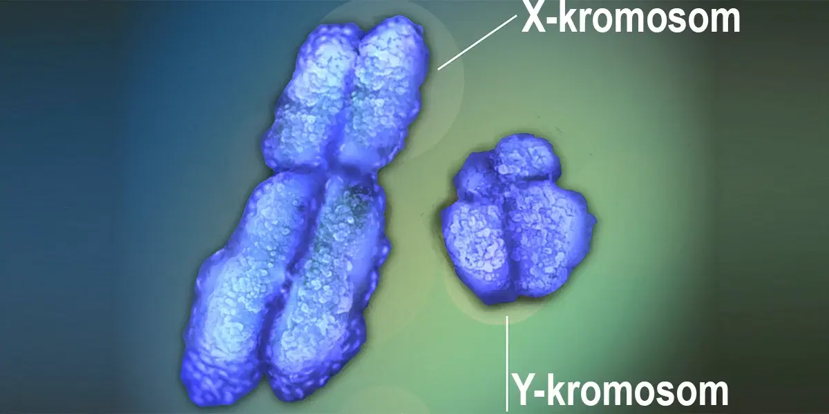 En X- och en Y-kromosom. Med åldern kan män förlora sin Y-kromosom och det är kan påverka uppkomsten av flera sjukdomar.