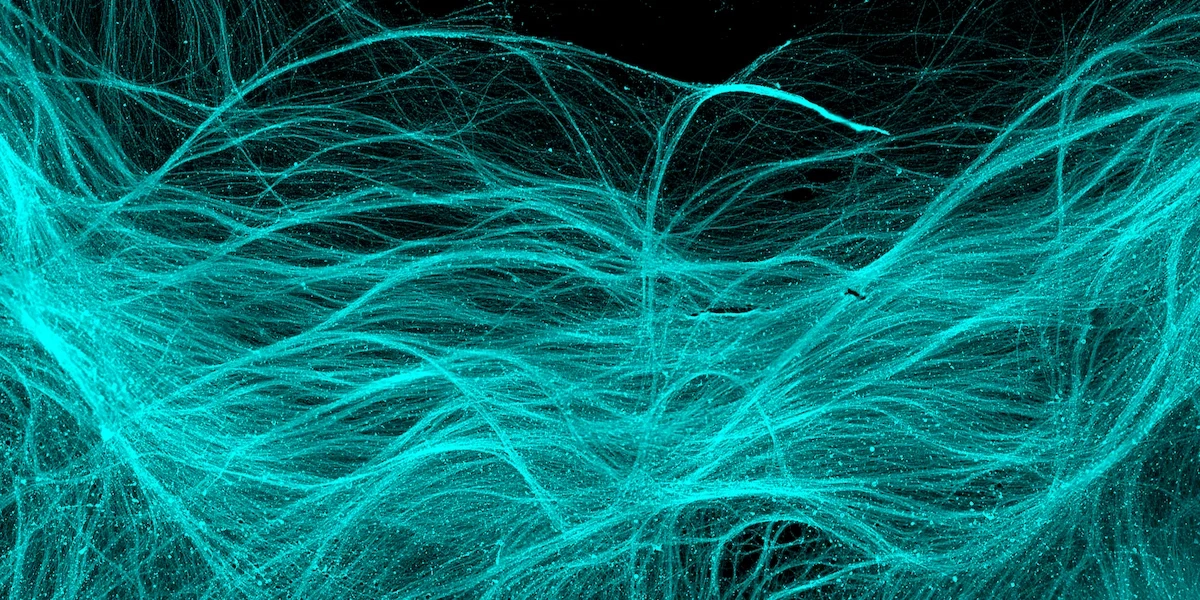 Fibrer från dopaminneuroner odlade i cellkultur. En ny studie visar att transplanterade stamceller överlever i hjärnan vid Parkinsons.